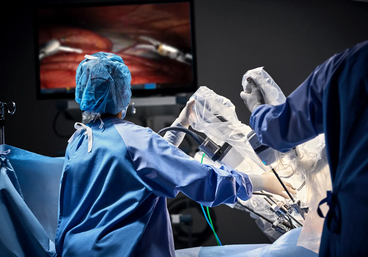 Operating room staff around a da Vinci surgical robot and its vision cart